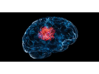 expert-surgical-support-for-complex-brain-tumor-conditions-small-0