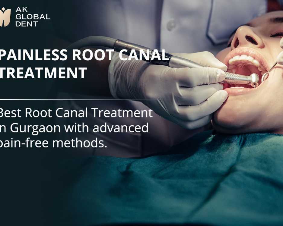 best-root-canal-treatment-in-gurgaon
