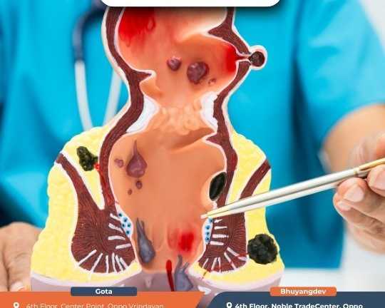 best-fissure-doctor-in-ahmedabad-gastro1-hospital