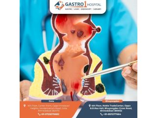 best-fissure-doctor-in-ahmedabad-gastro1-hospital-small-0