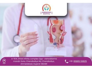 trusted-hospital-for-pilonidal-sinus-treatment-in-ahmedabad-small-0