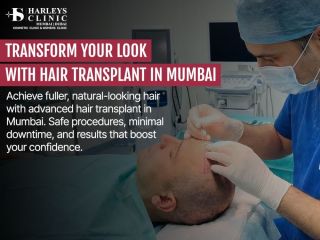 best-hair-transplant-in-mumbai-for-permanent-hair-growth-small-0