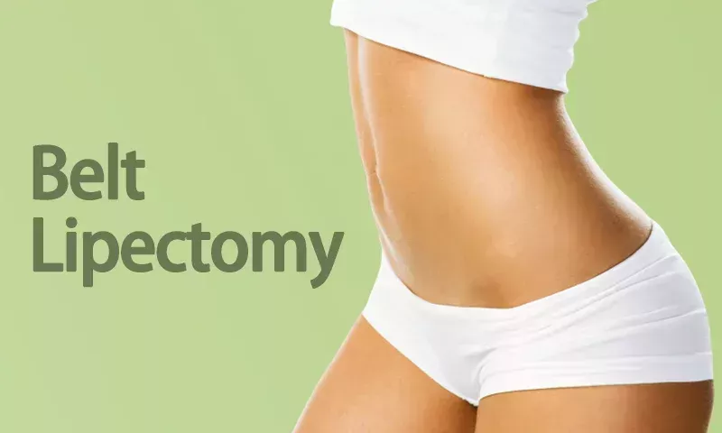 belt-lipectomy-in-mumbai-360-body-contouring-surgery-big-1