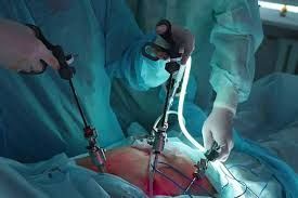 affordable-gallbladder-stone-operation-package-in-kolkata-big-0