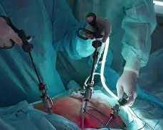 affordable-gallbladder-stone-operation-package-in-kolkata
