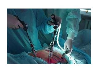 affordable-gallbladder-stone-operation-package-in-kolkata-small-0