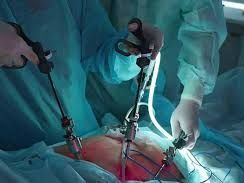 affordable-gallbladder-stone-operation-package-in-kolkata
