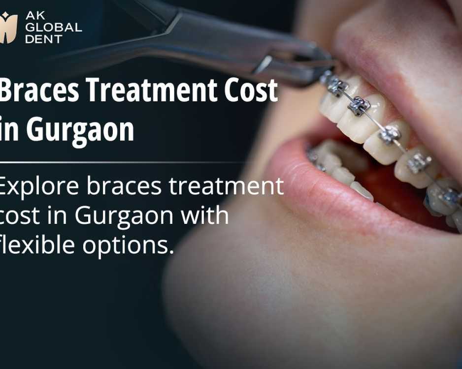 best-braces-treatment-cost-in-gurgaon
