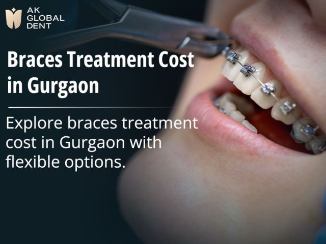 best-braces-treatment-cost-in-gurgaon