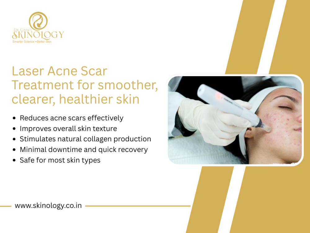 best-laser-treatment-for-active-acne-in-indore-skinology-big-0