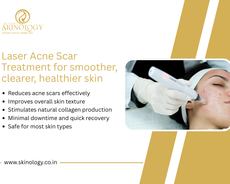 best-laser-treatment-for-active-acne-in-indore-skinology