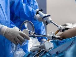 bariatric-endoscopy-treatment-ludhiana-for-weight-control