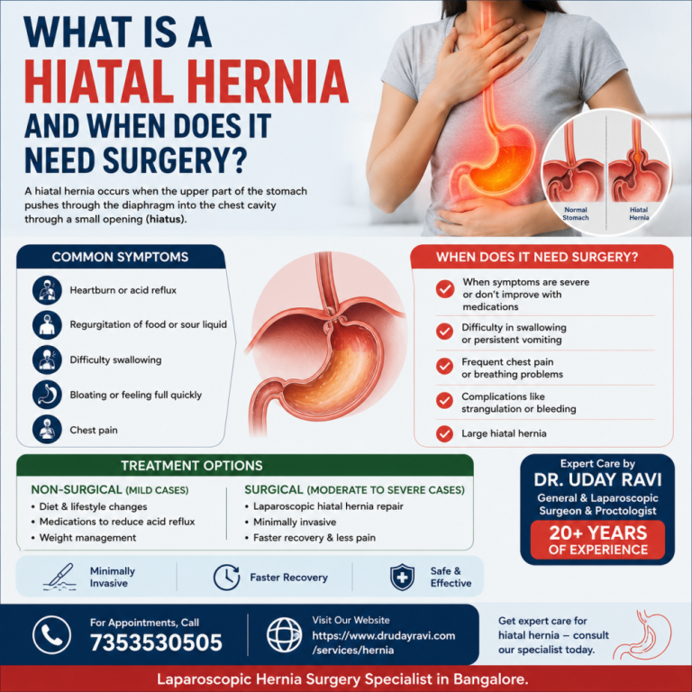 what-is-a-hiatal-hernia-and-when-does-it-need-surgery-big-0