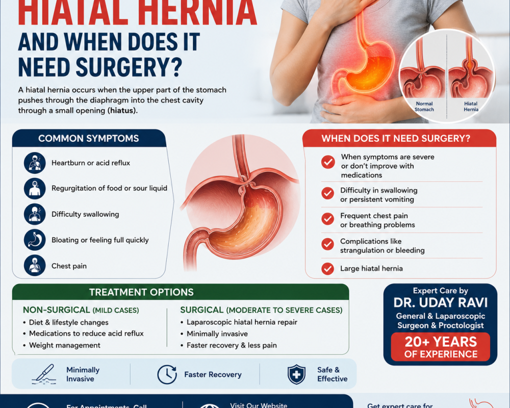 what-is-a-hiatal-hernia-and-when-does-it-need-surgery