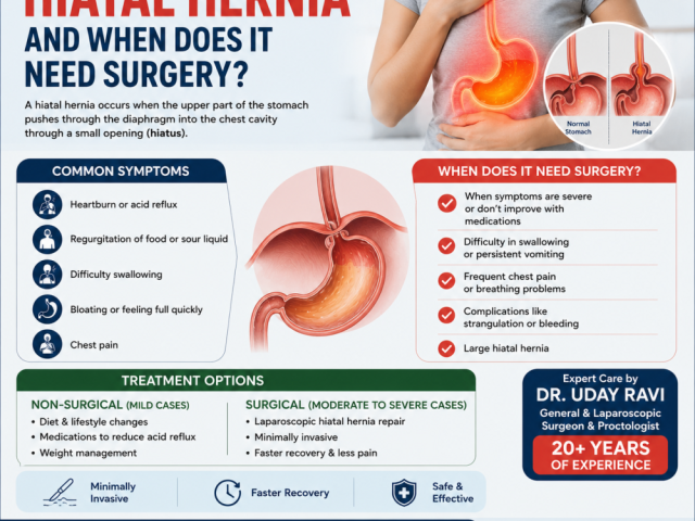 what-is-a-hiatal-hernia-and-when-does-it-need-surgery