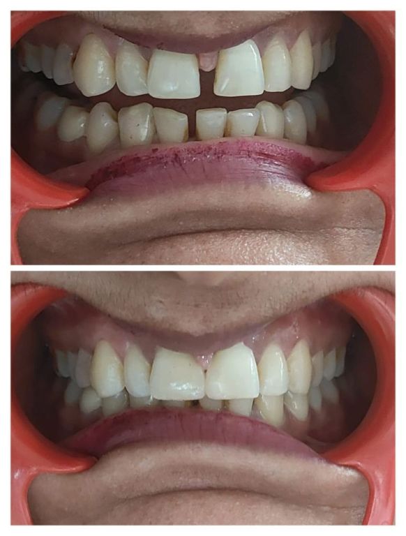top-rated-cghs-empanelled-dental-clinic-in-dwarka-sector-11-big-0