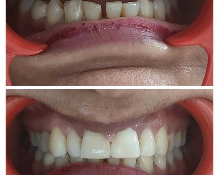 top-rated-cghs-empanelled-dental-clinic-in-dwarka-sector-11