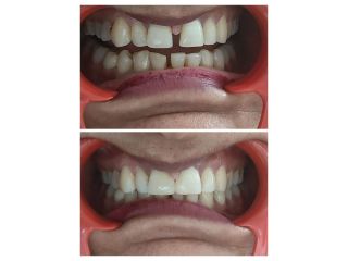 top-rated-cghs-empanelled-dental-clinic-in-dwarka-sector-11-small-0