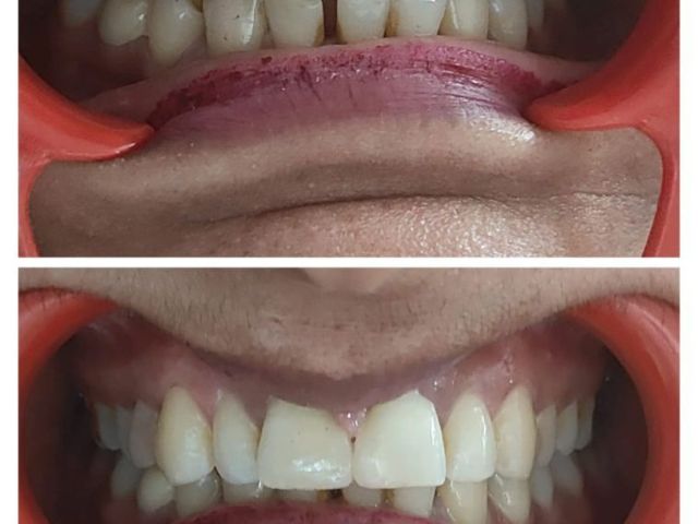 top-rated-cghs-empanelled-dental-clinic-in-dwarka-sector-11