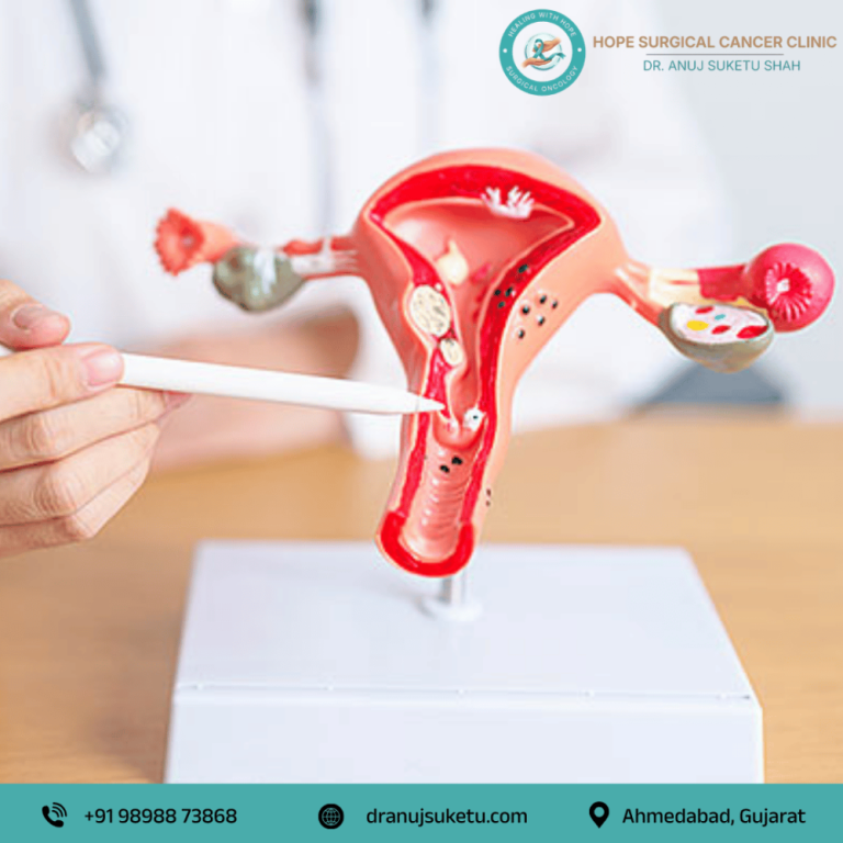 advanced-gynecological-cancer-treatment-in-ahmedabad-big-0