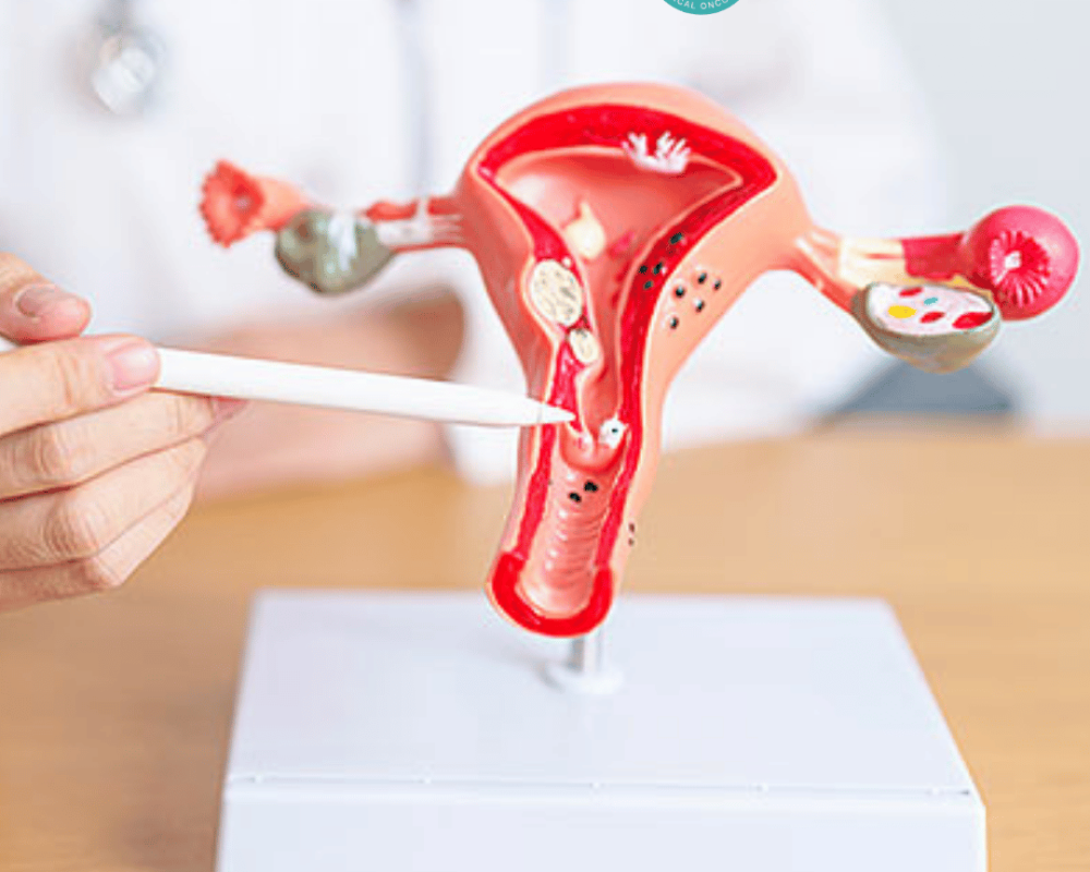 advanced-gynecological-cancer-treatment-in-ahmedabad