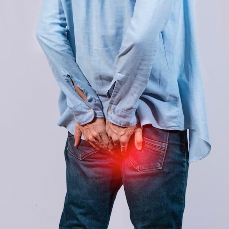 searching-for-a-fissure-specialist-in-noida-big-0