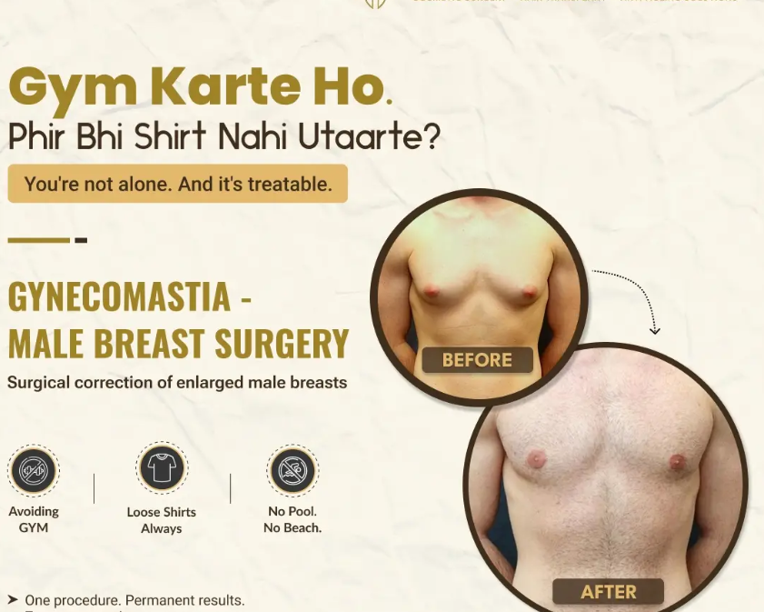 expert-gynecomastia-treatment