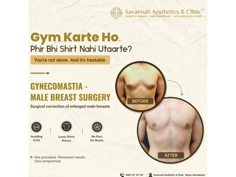 expert-gynecomastia-treatment-small-0