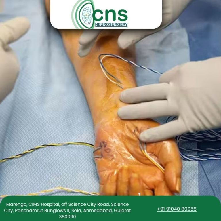 safe-advanced-peripheral-nerve-repair-in-ahmedabad-big-0