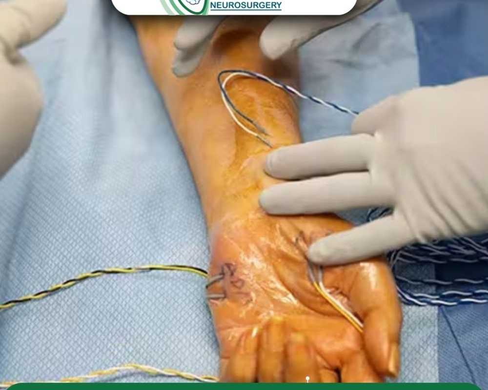 safe-advanced-peripheral-nerve-repair-in-ahmedabad