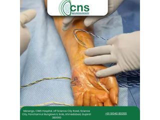 safe-advanced-peripheral-nerve-repair-in-ahmedabad-small-0