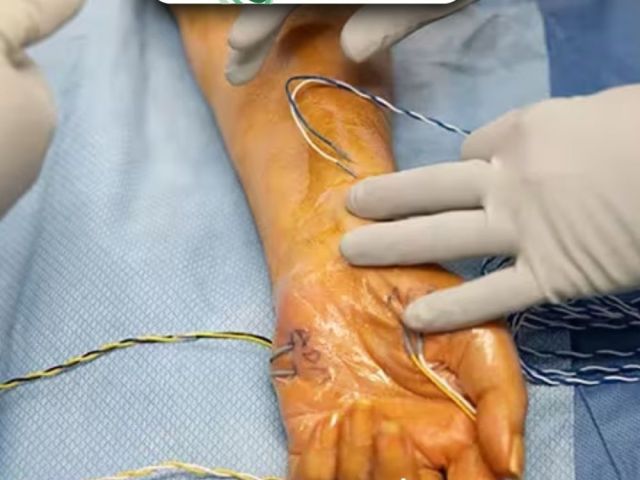 safe-advanced-peripheral-nerve-repair-in-ahmedabad