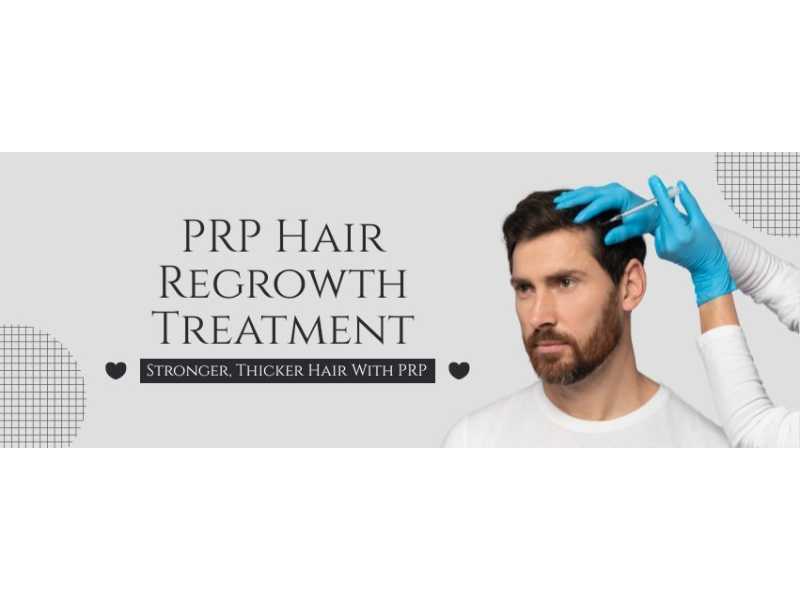 prp-hair-regrowth-treatment-advanced-hair-restoration-solutions-small-0