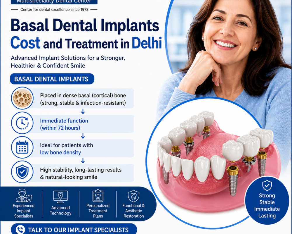 basal-dental-implants-cost-and-treatment-in-delhi
