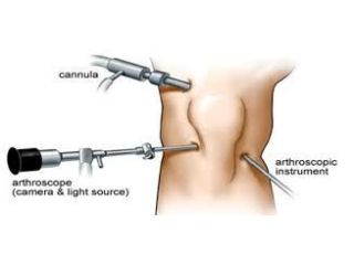 knee-arthroscopy-treatment-in-ahmedabad-signs-benefits-small-0