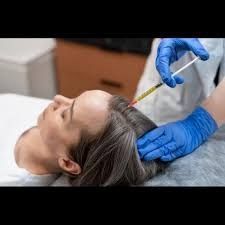 best-gfc-hair-treatment-in-delhi-at-citrine-clinic-big-0