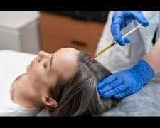 best-gfc-hair-treatment-in-delhi-at-citrine-clinic