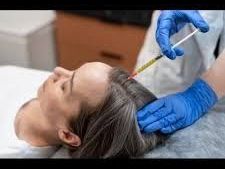 best-gfc-hair-treatment-in-delhi-at-citrine-clinic