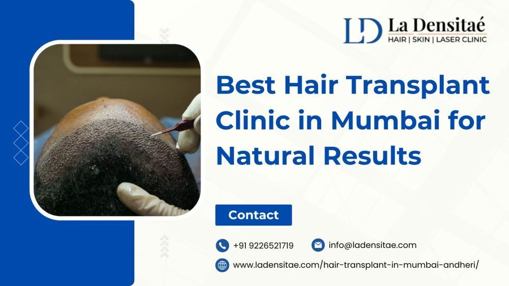 best-hair-transplant-clinic-in-mumbai-for-natural-results-big-0