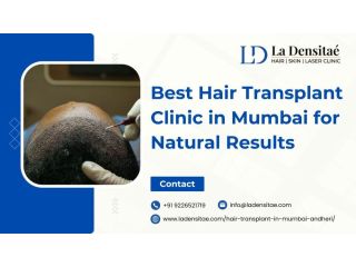 best-hair-transplant-clinic-in-mumbai-for-natural-results-small-0