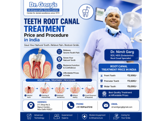 teeth-root-canal-treatment-price-and-procedure-in-india-small-0