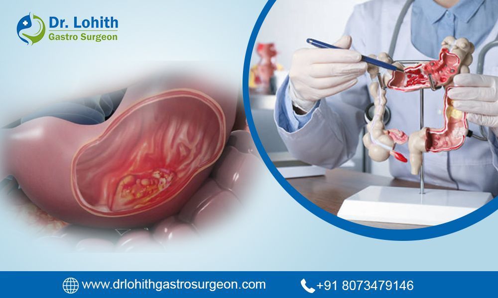 best-gastrointestinal-oncology-surgery-in-bangalore-big-0