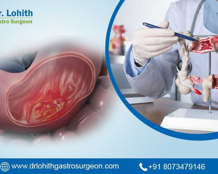 best-gastrointestinal-oncology-surgery-in-bangalore