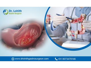 best-gastrointestinal-oncology-surgery-in-bangalore-small-0