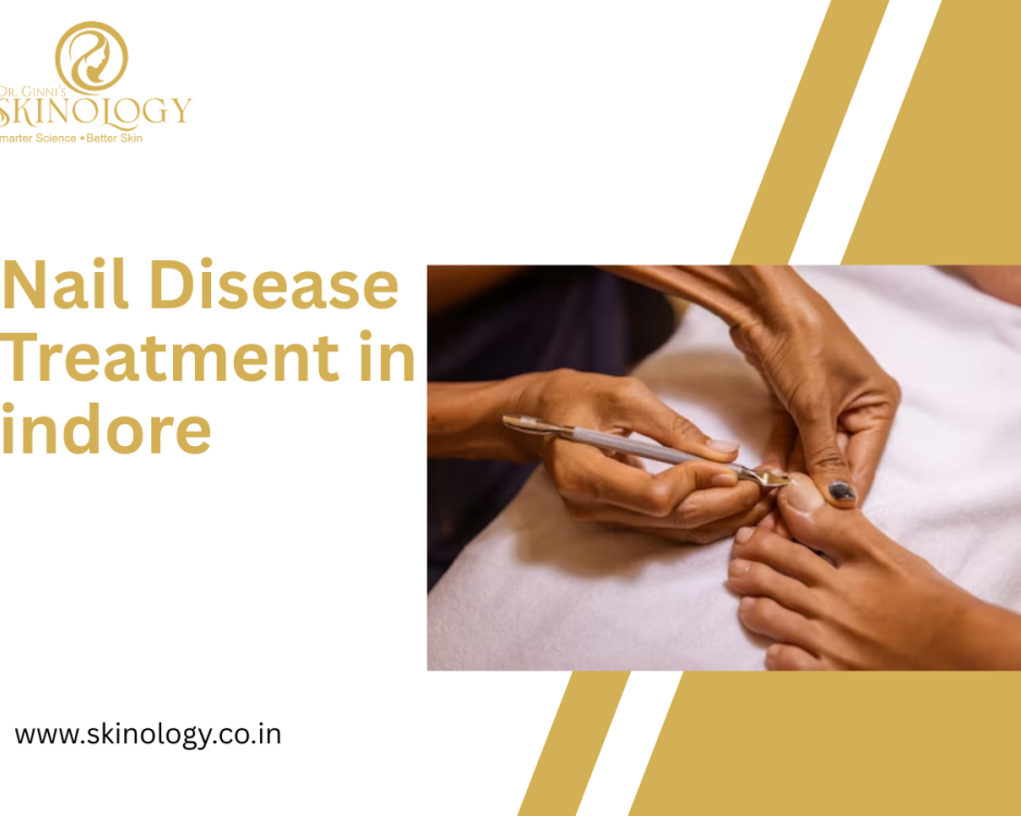 nail-disease-treatment-in-indore-skinology-clinic
