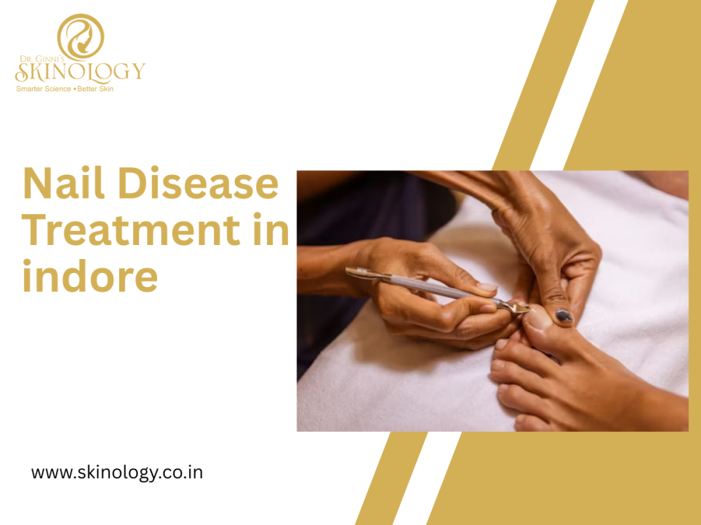 nail-disease-treatment-in-indore-skinology-clinic-big-0