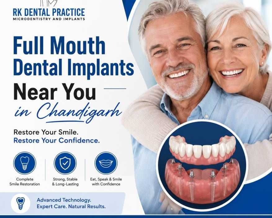 full-mouth-dental-implants-near-you-in-chandigarh