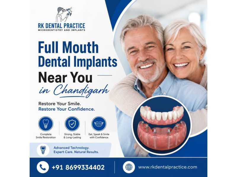 full-mouth-dental-implants-near-you-in-chandigarh-small-0