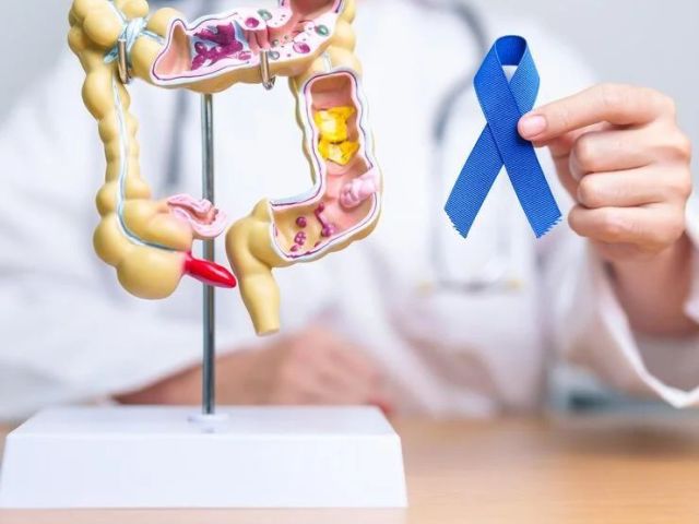 trusted-colorectal-cancer-doctor-in-noida-for-treatment