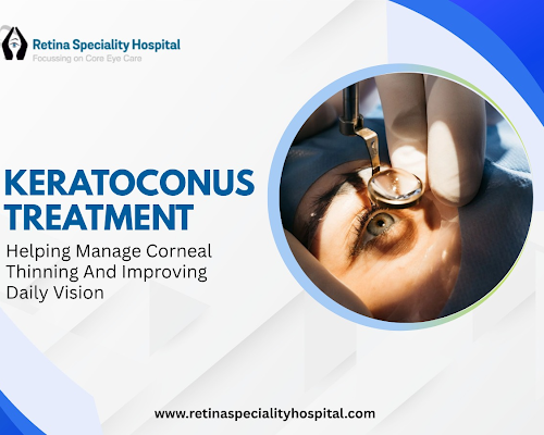 advanced-keratoconus-treatment-solutions-by-expert